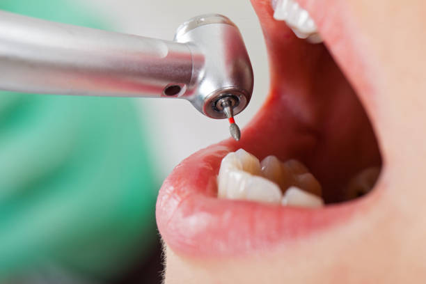 Best Emergency Root Canal Therapy in Mckinley, PA